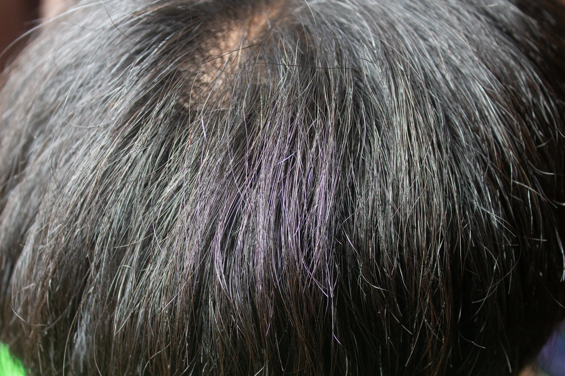 After MelaninReagain