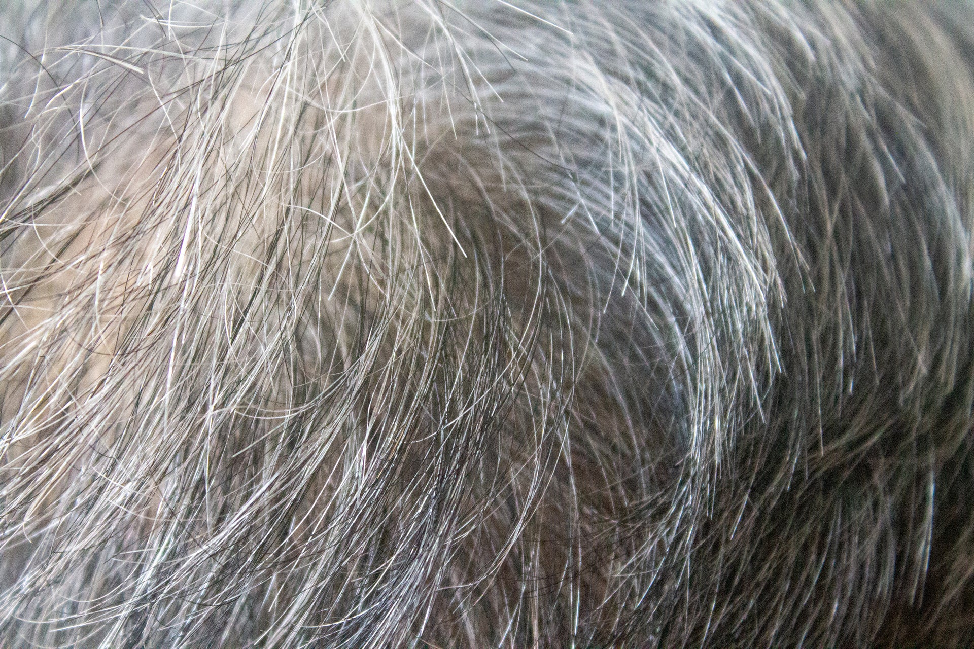 Before MelaninReagain